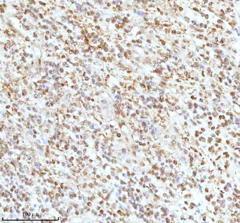 Ku70/XRCC6 Antibody