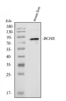 Butyrylcholinesterase/BCHE Rabbit Polyclonal Antibody