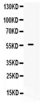BMPR1B Rabbit Polyclonal Antibody
