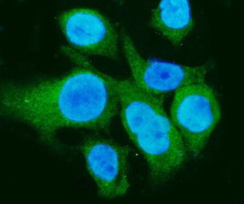 Carbonic Anhydrase I/CA1 Rabbit Polyclonal Antibody