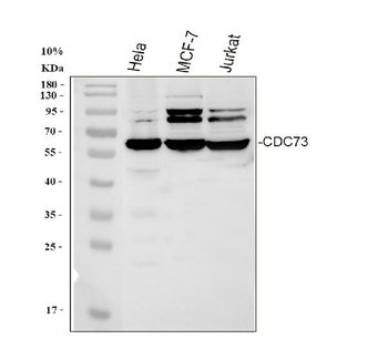 HRPT2/CDC73 Rabbit Polyclonal Antibody