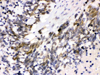 Cdk4 Rabbit Polyclonal Antibody