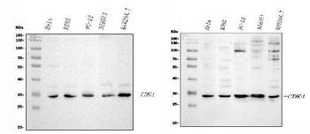 Cdk4 Rabbit Polyclonal Antibody