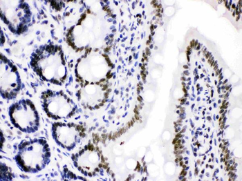 Cdk9 Rabbit Polyclonal Antibody