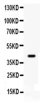 Cdk9 Rabbit Polyclonal Antibody