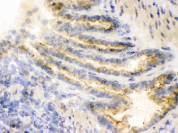 COMT Antibody