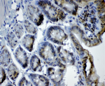 Cryptochrome I/CRY1 Rabbit Polyclonal Antibody