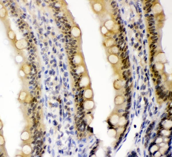 Cryptochrome I/CRY1 Rabbit Polyclonal Antibody