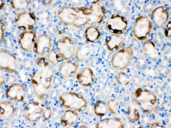 Cytochrome P450 1A1/CYP1A1 Antibody