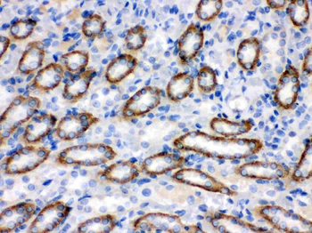 CYP1B1 Rabbit Polyclonal Antibody