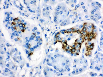 CYP24A1 Antibody