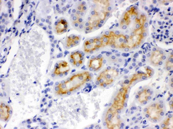 CYP24A1 Antibody