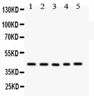 CCN1/CYR61 Rabbit Polyclonal Antibody