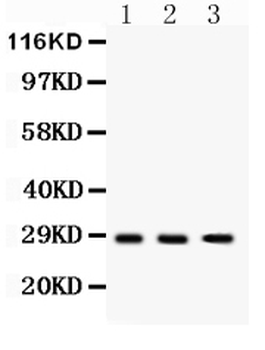 DKK2 Rabbit Polyclonal Antibody