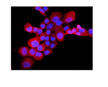 Endothelin B Receptor/EDNRB Rabbit Polyclonal Antibody
