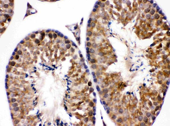 Endothelin B Receptor/EDNRB Rabbit Polyclonal Antibody