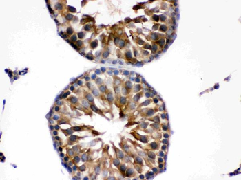 Endothelin B Receptor/EDNRB Rabbit Polyclonal Antibody