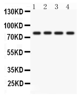 PKC eta/PRKCH Rabbit Polyclonal Antibody