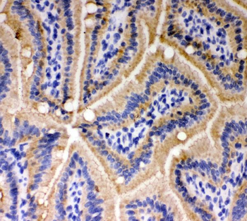 E Cadherin 1/CDH1 Antibody
