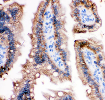 E Cadherin 1/CDH1 Antibody