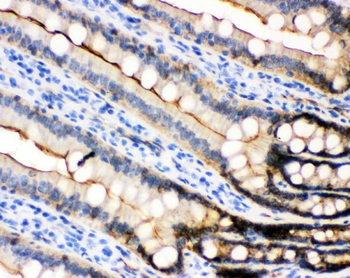 E Cadherin 1/CDH1 Antibody
