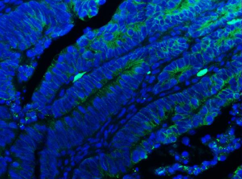 E Cadherin 1/CDH1 Antibody