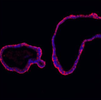E Cadherin 1/CDH1 Antibody