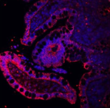 E Cadherin 1/CDH1 Antibody