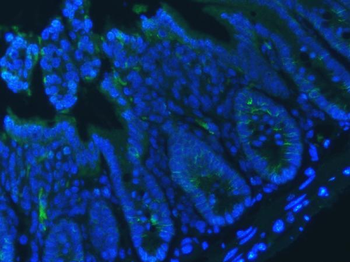 E Cadherin 1/CDH1 Antibody