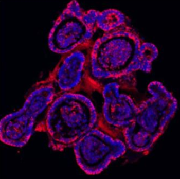 E Cadherin 1/CDH1 Antibody