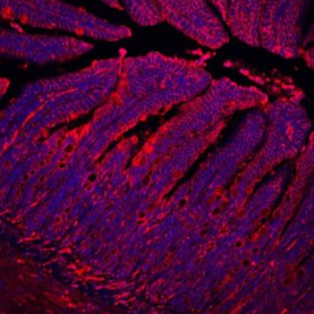 E Cadherin 1/CDH1 Antibody