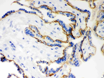 E Cadherin 1/CDH1 Antibody