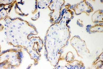 E Cadherin 1/CDH1 Antibody