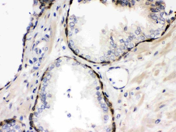 Stefin B/CSTB Rabbit Polyclonal Antibody