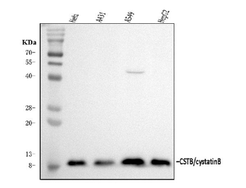 Stefin B/CSTB Rabbit Polyclonal Antibody