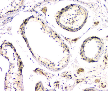 DMRT1 Rabbit Polyclonal Antibody