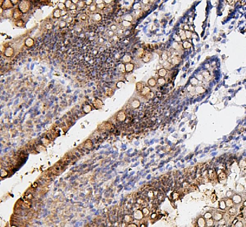 Fos B/FOSB Rabbit Polyclonal Antibody