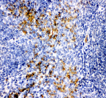 MCP1/CCL2 Antibody