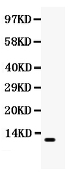 MCP1/CCL2 Antibody