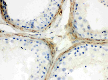 Apolipoprotein J/CLU Rabbit Polyclonal Antibody