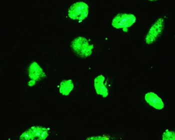 EWSR1 Antibody