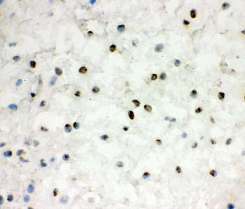 EWSR1 Antibody