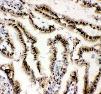 EWSR1 Antibody