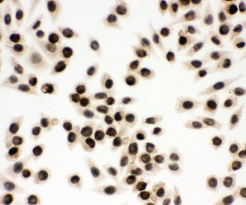 EWSR1 Antibody