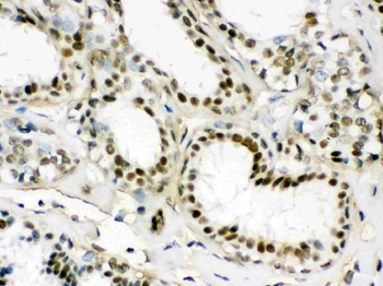 EWSR1 Antibody
