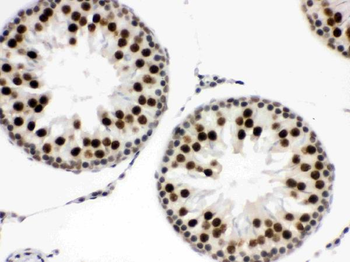 EWSR1 Antibody