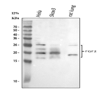 FGF2 Rabbit Polyclonal Antibody
