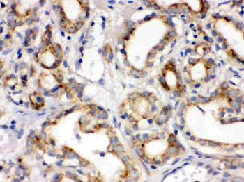 Frizzled homolog 1/FZD1 Rabbit Polyclonal Antibody