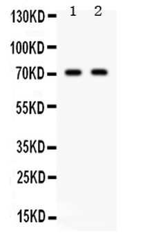 Frizzled homolog 1/FZD1 Rabbit Polyclonal Antibody