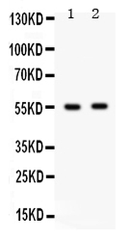 GABA A Receptor beta 3/GABRB3 Rabbit Polyclonal Antibody